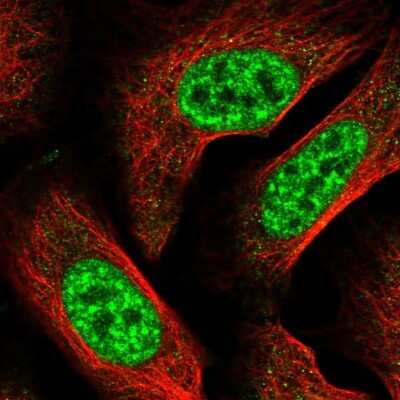 Immunocytochemistry/Immunofluorescence: RBBP6 Antibody [NBP2-47311] - Immunofluorescent staining of human cell line U-2 OS shows localization to nuclear speckles.