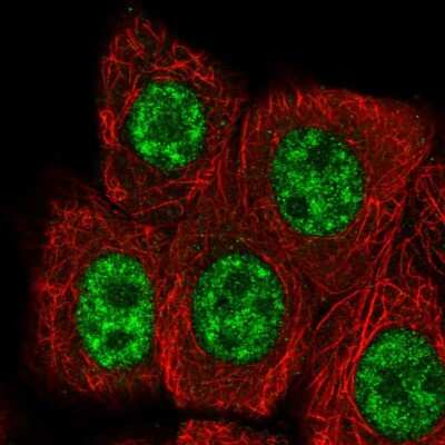 Immunocytochemistry/Immunofluorescence: RBBP6 Antibody [NBP2-58777] - Staining of human cell line MCF7 shows localization to nuclear speckles.