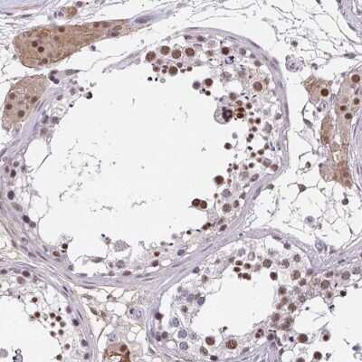 Immunohistochemistry: RBBP6 Antibody [NBP2-47311] - Staining of human testis shows moderate nuclear positivity in cells in seminiferus ducts while additional cytoplasmic staining in Leydig cells.