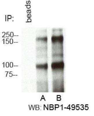 <b>Independent Antibodies Validation. </b>Immunoprecipitation: RBBP6 Antibody [NBP1-49535] - Immunoprecipitation of RbBP6 from HeLa cells using A. NBP1-49542 and B. NBP1-49535.