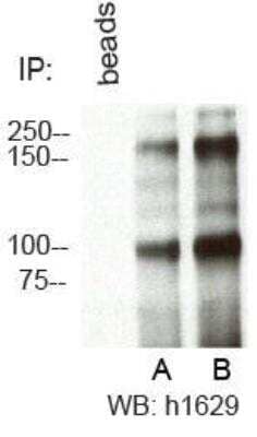 Immunoprecipitation: RBBP6 Antibody [NBP1-49542] - Immunoprecipitation of RbBP6 from HeLa cells using A. NBP1-49542 and B. NBP1-49535.