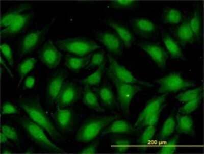 Immunocytochemistry/Immunofluorescence: RBBP9 Antibody (2A11) [H00010741-M01] - Analysis of monoclonal antibody to RBBP9 on HeLa cell. Antibody concentration 10 ug/ml.