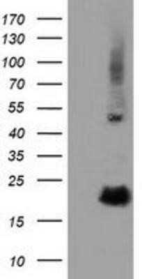 Western Blot: RBBP9 Antibody (OTI4G3) - Azide and BSA Free [NBP2-73828] - HEK293T cells were transfected with the pCMV6-ENTRY control (Left lane) or pCMV6-ENTRY RBBP9 (Right lane) cDNA for 48 hrs and lysed. Equivalent amounts of cell lysates (5 ug per lane) were separated by SDS-PAGE and immunoblotted with anti-RBBP9.