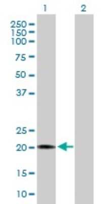 Western Blot: RBBP9 Antibody [H00010741-B01P] - Analysis of RBBP9 expression in transfected 293T cell line by RBBP9 polyclonal antibody.  Lane 1: RBBP9 transfected lysate(20.46 KDa). Lane 2: Non-transfected lysate.