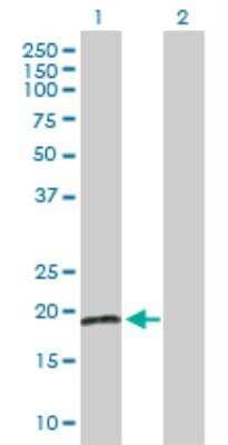 Western Blot: RBBP9 Antibody [H00010741-D01F] - analysis of RBBP9 expression in transfected 293T cell line by RBBP9 affinity purified MaxPab rabbit polyclonal antibody. Lane 1: RBBP9 transfected lysate (21.00 KDa). Lane 2: Non-transfected lysate.