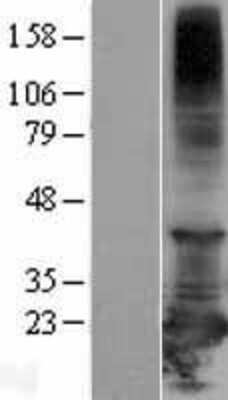 Western Blot RBBP9 Overexpression Lysate
