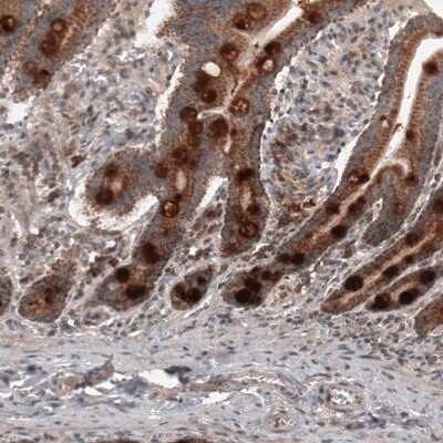 Immunohistochemistry-Paraffin: RBCK1 Antibody (CL4289) [NBP2-59048] - Staining of human duodenum shows strong cytoplasmic immunoreactivity in glandular cells.