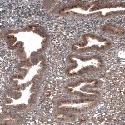 Immunohistochemistry-Paraffin: RBCK1 Antibody (CL4289) [NBP2-59048] - Staining of human endometrium shows cytoplasmic positivity in glandular cells.