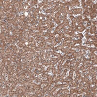 Immunohistochemistry-Paraffin: RBCK1 Antibody (CL4289) [NBP2-59048] - Staining of human liver shows cytoplasmic immunoreactivity in hepatocytes.