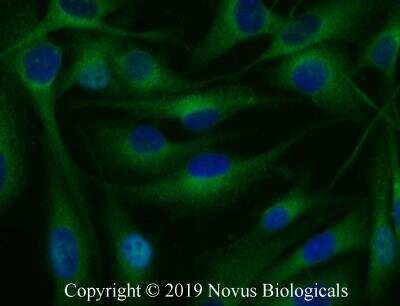 Immunocytochemistry/Immunofluorescence: RBCK1 Antibody [NBP2-27105] - SK-MEL-28 cells were fixed for 10 minutes using 10% formalin and then permeabilized for 5 minutes using 1X PBS + 0.05% Triton-X100. The cells were incubated with anti-RBCK1 at 10 ug/ml overnight at 4C and detected with an anti-rabbit Dylight 488 (Green) at a 1:500 dilution. Nuclei were counterstained with DAPI (Blue). Cells were imaged using a 40X objective.