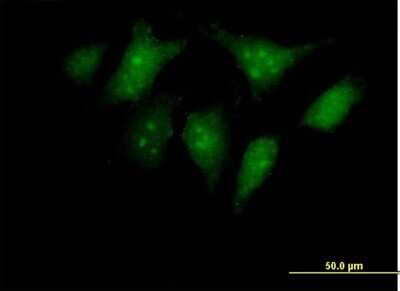 Immunocytochemistry/Immunofluorescence: RBED1 Antibody [H00084173-B01P] - Analysis of purified antibody to RBED1 on HeLa cell. (antibody concentration 10 ug/ml)