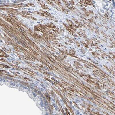 Immunohistochemistry-Paraffin: RBED1 Antibody [NBP1-89848] - Staining shows moderate cytoplasmic positivity in smooth muscle cells.