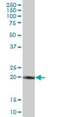 Western Blot: RBED1 Antibody [H00084173-B01P] - Analysis of RBED1 expression in human kidney.