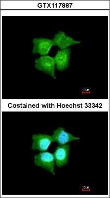Immunocytochemistry/Immunofluorescence: RBEL1 Antibody [NBP2-20098] - Immunofluorescence analysis of paraformaldehyde-fixed A431, using antibody at 1:200 dilution.