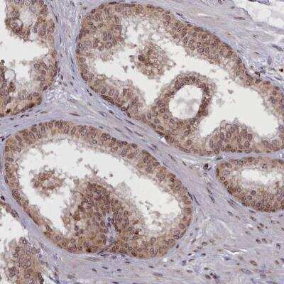 Immunohistochemistry-Paraffin: RBEL1 Antibody [NBP1-91741] - Immunohistochemical staining of human prostate shows moderate cytoplasmic and nuclear positivity in glandular cells.