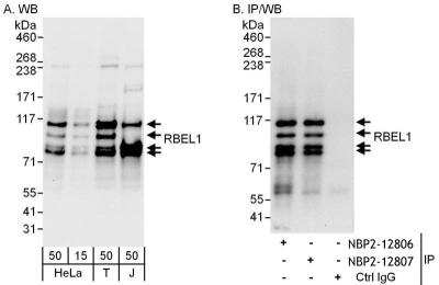 Immunoprecipitation: RBEL1 Antibody [NBP2-12806] - Samples:  Whole cell lysate from HeLa (15 and 50 ug for WB; 1 mg for IP, 20% of IP loaded), 293T (T; 50 ug) and Jurkat (J; 50 ug) cells.  Antibodies: Affinity purified rabbit anti-RBEL1 antibody NBP2-12806 used for WB at 0.1 ug/ml (A) and 1 ug/ml (B) and used for IP at 6 ug/mg lysate.  RBEL1 was also immunoprecipitated by rabbit anti-RBEL1 antibody NBP2-12807, which recognizes a downstream epitope.  Detection: Chemiluminescence with exposure times of 10 seconds (A) and 3 seconds (B).
