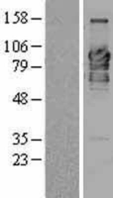 Western Blot: RBEL1 Overexpression Lysate (Adult Normal) [NBL1-08605] Left-Empty vector transfected control cell lysate (HEK293 cell lysate); Right -Over-expression Lysate for RBEL1.