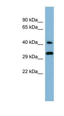 Western Blot: RBJ Antibody [NBP1-58940] - Human kidney lysate, concentration 0.2-1 ug/ml.