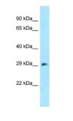 Western Blot: RBJ Antibody [NBP1-98571] - Titration: 1.0 ug/ml Positive Control: Mouse Kidney.
