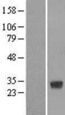 Western Blot: RBJ Overexpression Lysate (Adult Normal) [NBL1-15190] Left-Empty vector transfected control cell lysate (HEK293 cell lysate); Right -Over-expression Lysate for RBJ.
