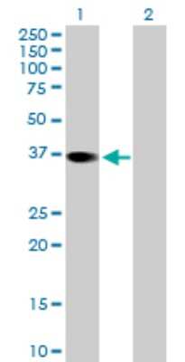 Western Blot: RBKS Antibody [H00064080-B01P] - Analysis of RBKS expression in transfected 293T cell line by RBKS polyclonal antibody.  Lane 1: RBKS transfected lysate(35.53 KDa). Lane 2: Non-transfected lysate.