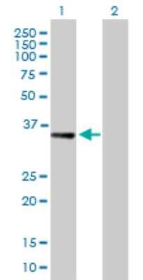Western Blot: RBKS Antibody [H00064080-B02P] - analysis of RBKS expression in transfected 293T cell line by RBKS purified MaxPab polyclonal antibody (B02P). Lane 1: RBKS transfected lysate (34.10 KDa). Lane 2: Non-transfected lysate.