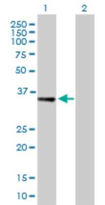 Western Blot: RBKS Antibody [H00064080-B02P] - Analysis of RBKS expression in transfected 293T cell line by RBKS polyclonal antibody.  Lane 1: RBKS transfected lysate(35.42 KDa). Lane 2: Non-transfected lysate.
