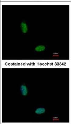 Immunocytochemistry/Immunofluorescence: RBM10 Antibody [NBP2-20100] - Immunofluorescence analysis of paraformaldehyde-fixed HeLa, using antibody at 1:500 dilution.