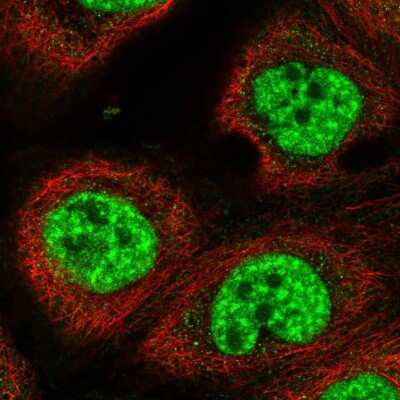 Immunocytochemistry/Immunofluorescence: RBM10 Antibody [NBP2-56831] - Staining of human cell line A-431 shows localization to nuclear speckles.