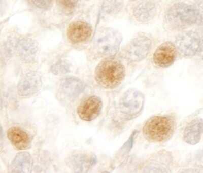 <b>Independent Antibodies Validation. </b>Immunohistochemistry-Paraffin: RBM10 Antibody [NB100-55265] - Sample: FFPE section of human testicular seminoma. Antibody: Affinity purified rabbit anti- RBM10 used at a dilution of 1:200 (1ug/ml). Detection: DAB