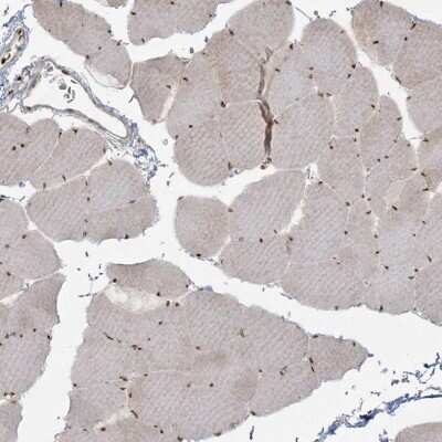 Immunohistochemistry-Paraffin: RBM10 Antibody [NBP1-84951] - Staining of human skeletal muscle shows moderate nuclear positivity in myocytes.