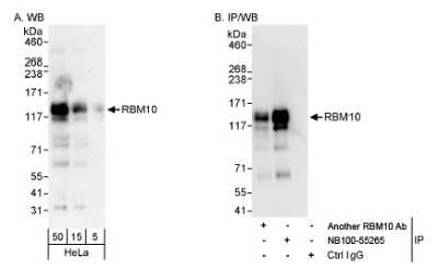 Western Blot: RBM10 Antibody [NB100-55265] - Whole cell lysate (5, 15 and 50 mcg for WB; 1 mg for IP, 20% of IP loaded) from HeLa cells.  NB100-55265 used for WB at 0.04 mcg/ml (A) and 1 mcg/ml (B) and used for IP at 3 mcg/mg lysate (B). RBM10 was also immunoprecipitated by another rabbit anti-RBM10 antibody, which recognizes an upstream epitope.