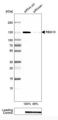 Western Blot: RBM10 Antibody [NBP1-84951] - Analysis in A-549 cells transfected with control siRNA, target specific siRNA probe #1, using Anti-RBM10 antibody. Remaining relative intensity is presented. Loading control: Anti-GAPDH.