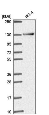 Western Blot: RBM10 Antibody [NBP2-56831] - Western blot analysis in human cell line RT-4.