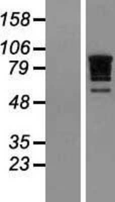 Western Blot: RBM10 Overexpression Lysate (Adult Normal) [NBL1-15194] - Western Blot experiments.  Left-Control; Right -Over-expression Lysate for RBM10.