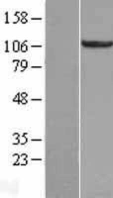 Western Blot: RBM10 Overexpression Lysate (Adult Normal) [NBL1-15195] Left-Empty vector transfected control cell lysate (HEK293 cell lysate); Right -Over-expression Lysate for RBM10.