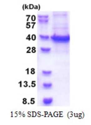 SDS-PAGE Recombinant Human RBM11 His Protein