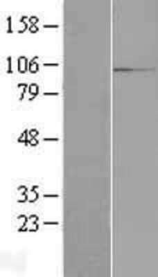 Western Blot: RBM12 Overexpression Lysate (Adult Normal) [NBP2-07676] Left-Empty vector transfected control cell lysate (HEK293 cell lysate); Right -Over-expression Lysate for RBM12.