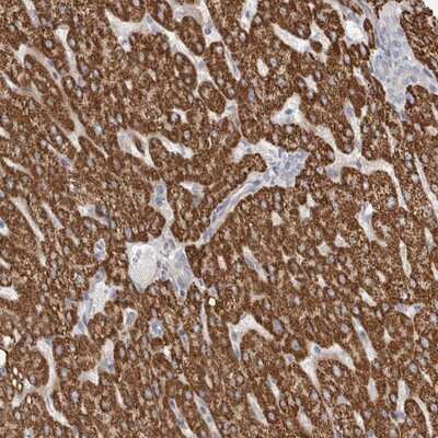 Immunohistochemistry-Paraffin: RBM12B Antibody [NBP1-85981] - Staining of human liver shows strong granular cytoplasmic positivity in hepatocytes.