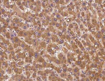 Immunohistochemistry-Paraffin: RBM12B Antibody [NBP3-12629] - Staining of human RBM12B in human liver with rabbit polyclonal antibody at 1:500 dilution.