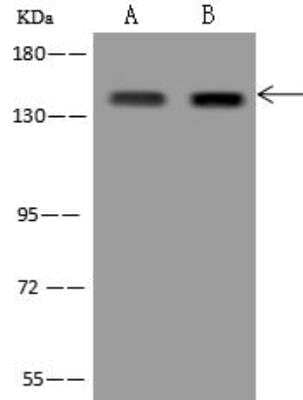 Western Blot: RBM12B Antibody [NBP3-12629] - Lane A: HeLa Whole Cell LysateLane B: U-251MG Whole Cell LysateLysates/proteins at 30 ug per lane.SecondaryGoat Anti-Rabbit IgG (H+L)/HRP at 1/10000 dilution.Developed using the ECL technique.Performed under reducing conditions.Predicted band size:118 kDaObserved band size:135 kDa