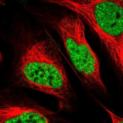 <b>Independent Antibodies Validation. </b>Immunocytochemistry/Immunofluorescence: RBM17 Antibody [NBP2-38348] - Staining  of human cell line U-2 OS shows positivity in nucleus but excluded from the nucleoli.