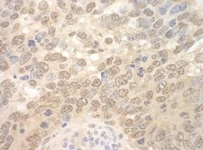 Immunohistochemistry: RBM17 Antibody [NBP1-80576] - Sample: FFPE section of mouse teratoma. Antibody: Affinity purified rabbit anti-SPF45 used at a dilution of 1:250 Detection: DAB staining using Immunohistochemistry Accessory Kit .