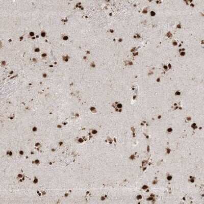 Immunohistochemistry: RBM17 Antibody [NBP2-38348] - Staining of human lateral ventricle shows strong nuclear positivity in neuronal and glial cells.