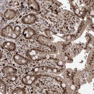 <b>Independent Antibodies Validation. </b>Immunohistochemistry-Paraffin: RBM17 Antibody [NBP1-81202] - Staining of human duodenum shows strong nuclear positivity in glandular cells.