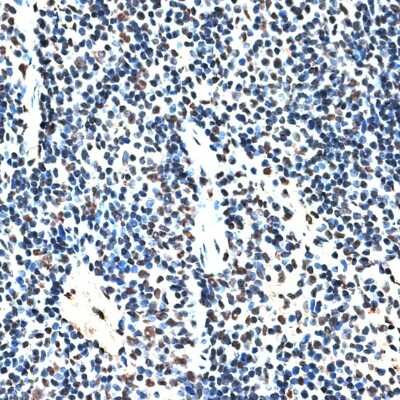 Immunohistochemistry-Paraffin: RBM17 Antibody [NBP2-94654] - Paraffin-embedded mouse spleen using RBM17 .