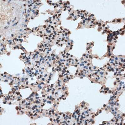 Immunohistochemistry-Paraffin: RBM17 Antibody [NBP2-94654] - Paraffin-embedded rat lung using RBM17 .
