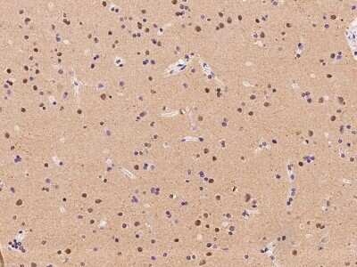 Immunohistochemistry-Paraffin: RBM17 Antibody [NBP2-97616] - Immunochemical staining of human RBM17 in human brain with rabbit polyclonal antibody at 1:100 dilution, formalin-fixed paraffin embedded sections.