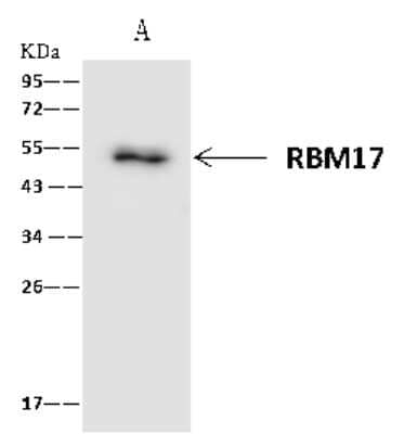 Immunoprecipitation: RBM17 Antibody [NBP2-97616] - RBM17 was immunoprecipitated using: Lane A: 0.5 mg Raji Whole Cell Lysate 4 ul anti-RBM17 rabbit polyclonal antibody and 60 ug of Immunomagnetic beads Protein A/G.  Primary antibody: Anti-RBM17 rabbit polyclonal antibody, at 1:100 dilution. Secondary antibody: Clean-Blot IP Detection Reagent (HRP) at 1:1000dilution. Developed using the ECL technique. Performed under reducing conditions. Predicted band size: 45 kDa. Observed band size: 45 kDa
