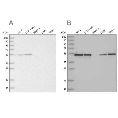 Western Blot RBM17 Antibody - BSA Free